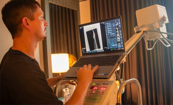 A VuePoint radiologic technologist reviewing a chest X-ray on a portable digital unit